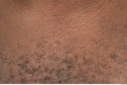 Photo Textures of Human Skin